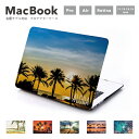 MacBook Pro 13 15 MacBook Air 11 13 MacBook 12 Retina 各モデル対応 カバー ケース マックブック シェルカバー プロテクターケース SUMMER アロハ ヤシの木 Palm tree ハワイアン Hawai リゾート バカンス サンセット 景色 【メール便発送不可】