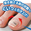 【即納】巻き爪リフトシール　1ヶ月ケア　リフトメタルがグイッと爪をサポート！
