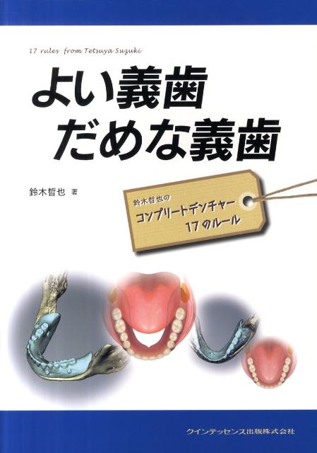 よい義歯だめな義歯【送料無料】