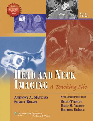 Head and Neck Imaging: A Teaching File【送料無料】