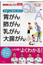 患者さんの疑問に答える「胃がん」「肺がん」「乳がん」「大腸がん」