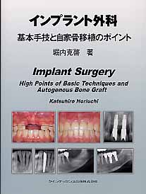 インプラント外科基本手技と自家骨移植のポイント