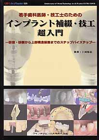 若手歯科医師・技工士のためのインプラント補綴・技工超入門