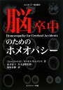 脳卒中のためのホメオパシー