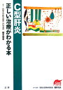 C型肝炎