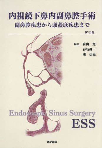 内視鏡下鼻内副鼻腔手術 副鼻腔疾患から頭蓋底疾患まで/森山寛/春名眞一/鴻信義【2500円以上送料無料】 内視鏡下鼻内副鼻腔手術 副鼻腔疾患から頭蓋底疾患まで/森山寛/春名眞一/鴻信義【2500円以上送料無料】
