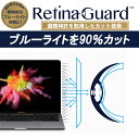 RetinaGuard Macbook ...