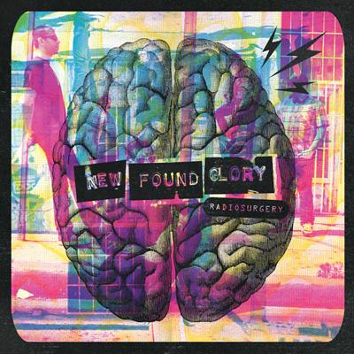 New Found Glory ニューファウンドグローリー / Radiosurgery 輸入盤 【CD】