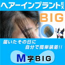 ヘアーインプラントEX M字用BIG(男性用かつら)※LFSテープ貼り付け済み