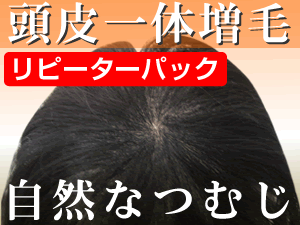 （リピーターパック）ヘアーインプラントEX つむじ用(※装着には別途、強力テープかスーパーシリコンの購入が必要です)【送料無料】（かつら・増毛・ウィッグ・男性用かつら・女性用かつら）