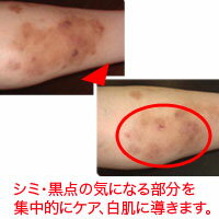 シミ.黒点の気になる部分を集中ケア。白肌に。