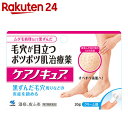 【第2類医薬品】ケアノキュア 20g