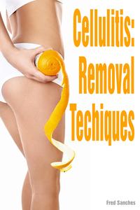 Cellulite Removal TechniquesydqЁz[ Fred Sanches ]