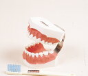 歯磨指導顎模型
