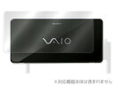 y[֔/\160zOverLay Protector for VAIO Type P(OPSVP90) ysz