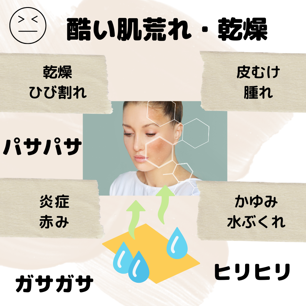 オーストラリア オーガニック 100% 天然素材 ラノリン シアバター スキン バーム クリーム Baa Ram Ewe Lanolin Skin Balm 120g 50g 保湿 乾燥対策 うるおい 敏感肌 万能バーム ホワイトデー バレンタイン 2024 入学