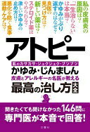 アトピー・かゆみ・じんましん 皮膚とアレルギーの名医が教える最高の治し方大全 聞きたくても聞けなかった146問に専門医が本音で回答! (健康実用) 佐伯秀久、 中原剛士、 ?森建二、 清益功浩; 小林美咲【中古】