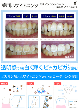 【 送料無料 】 再生医療から誕生！ デンタル ケア 歯を白く　健康なお口へ これで完璧オーラルケア セット 薬用 ポリリンシリーズ Wケアプログラム 3セット ( デンタルリンス & 歯みがきジェル）【 CPC配合 で 虫歯を予防 】