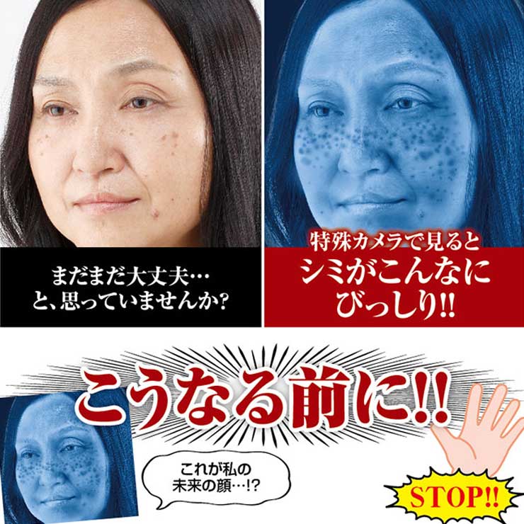 シミ取りクリーム シミ しみ しみ消し そばかす 透明肌 キメ うるおい 保湿 引き締め 美容クリーム 美肌 くすみ ブライトニング フェイスアップ フェイス 美容液 パック ピーリング シミ ハリ 薬用 薬用クロパックン