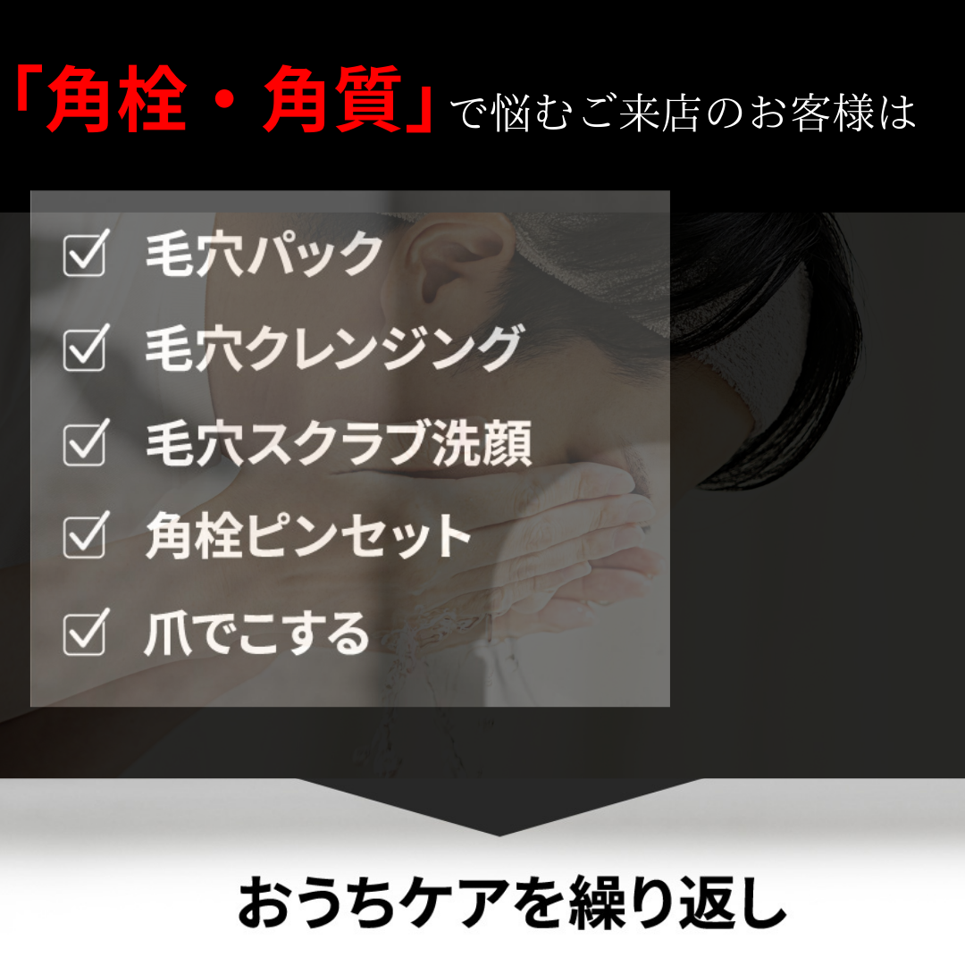【サロンクオリティ】ANRARE ピュアエッセンス メンズ 角栓ケア コスメ 鼻角栓 小鼻毛穴角栓黒ずみケア 角質ケア 角質除去 角質ケア顔洗顔 美肌 ゴワツキ 黒ずみ くすみ ザラつき 毛穴 毛穴ケアいちご鼻 毛穴黒ずみ 咲吉生糀甘酒
