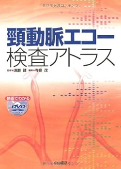 【中古】頸動脈エコー検査アトラス