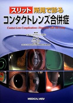 【中古】スリット所見で診る コンタクトレンズ合併症(3)