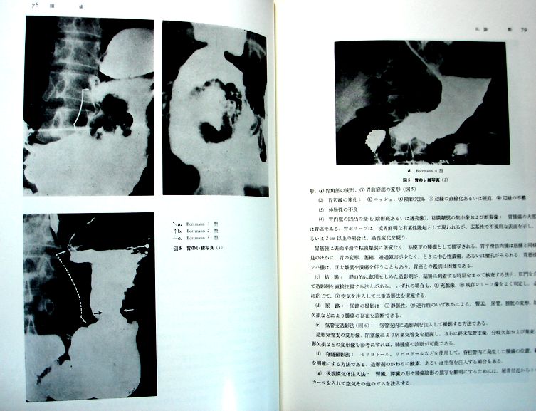 現代外科学大系　9　【腫瘍】