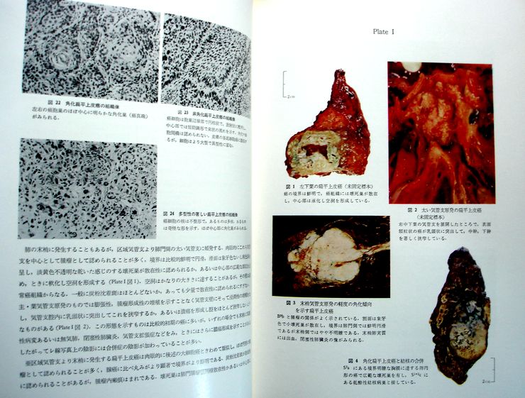 現代外科学大系　30 C　肺・気管支炎3