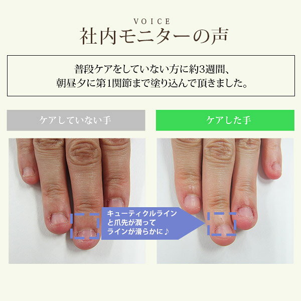 Sale キューティクルオイル 甘皮処理 Omd Gk10 ローズ 9ml 97 以上節約 ネイルオイル 爪 ネイル用品 美容液 セルフネイル 二枚爪 甘皮 ネイルサロン 割れ爪 ネイルケア