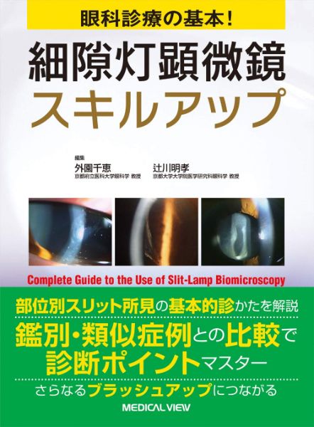 【取寄品】【取寄時、納期1〜3週間】細隙灯顕微鏡スキルアップ【沖縄・離島以外送料無料】