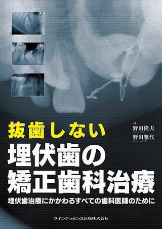 【取寄品】【取寄時、納期1～3週間】抜歯しない埋伏歯の矯正歯科治療【沖縄・離島以外送料無料】