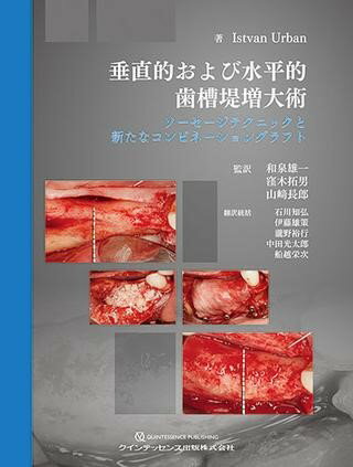 楽天市場】垂直的 水平的 歯槽堤増大 和泉の通販