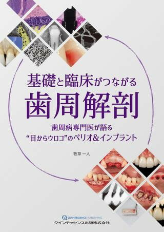 【取寄品】【取寄時、納期1〜3週間】基礎と臨床がつながる歯周解剖【沖縄・離島以...