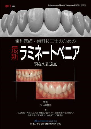 楽天市場】ラミネートベニアの通販