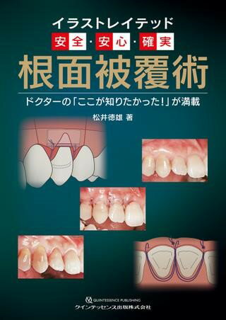 【取寄品】【取寄時、納期1〜3週間】イラストレイテッド 安全・安心・確実 根面被覆術【沖縄・離島以外送料無料】