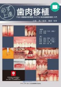 必ず上達 歯肉移植 FGG（遊離歯肉移植術）＆CTG（結合組織移植術）入門 [ 小田 茂 ]