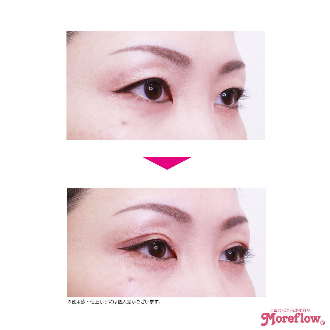 �⥢�ե�����������åɥꥭ�å� 8ml������̵���ۢ���ӥ塼��ƤǺ����դ�����åפ�ץ쥼��ȡ������������Ȥ���͵����ʡ��� ��Ťޤ֤� �� �����դ� ��� �����ץ� ���� �����ơ��� ��Ų����� ���� ��Ťޤ֤����������� ������Ź��