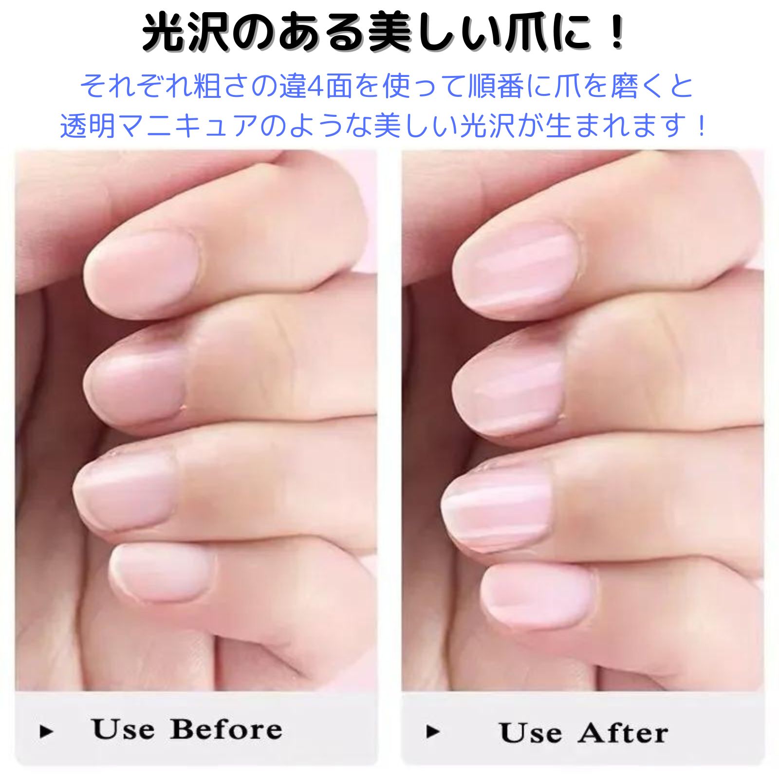 geneX ���᤭ ���ݥ� �ͥ��륱�� �Ĥ�Ф� 4�� 12�ĥ��å� ����Ǵ�ñ�ͥ��륱�� �ޤ䤹�� �ۥ磻��