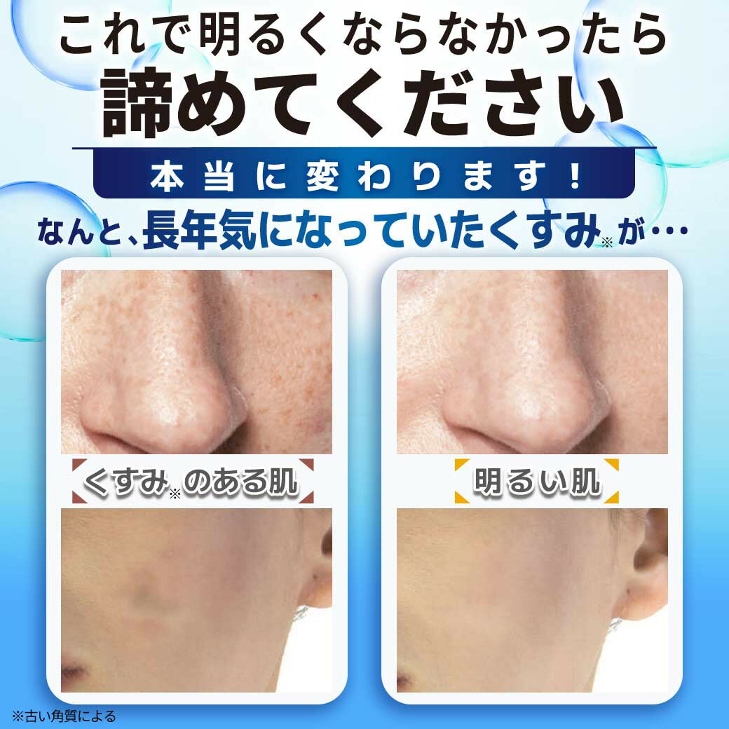 �����륤���󥲥륪���륤�����ݼ�������������ʥ��߿夿��