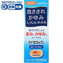 [BEAUTY]＜特徴＞・液体タイプで、スーッとここちよい清涼感を与えます。・首の部分が曲がっていて、スポンジがピッタリと接しますので、背中や腰などの塗りにくい患部にもスムーズにむらなく適量を塗布できます。・かゆみや炎症を抑える成分として、デキサメタゾン酢酸エステル、ジフェンヒドラミン塩酸塩を配合しています。・かゆみを抑える成分として、l-メントール、dl-カンフルを配合しています。・殺菌作用のある成分として、イソプロピルメチルフェノールを配合しています。 原産国日本 商品サイズ幅46mm×高さ118mm×奥行き33mm ※予告なくパッケージ、商品名、内容量、成分が変更になる場合がございます。予めご了承ください。