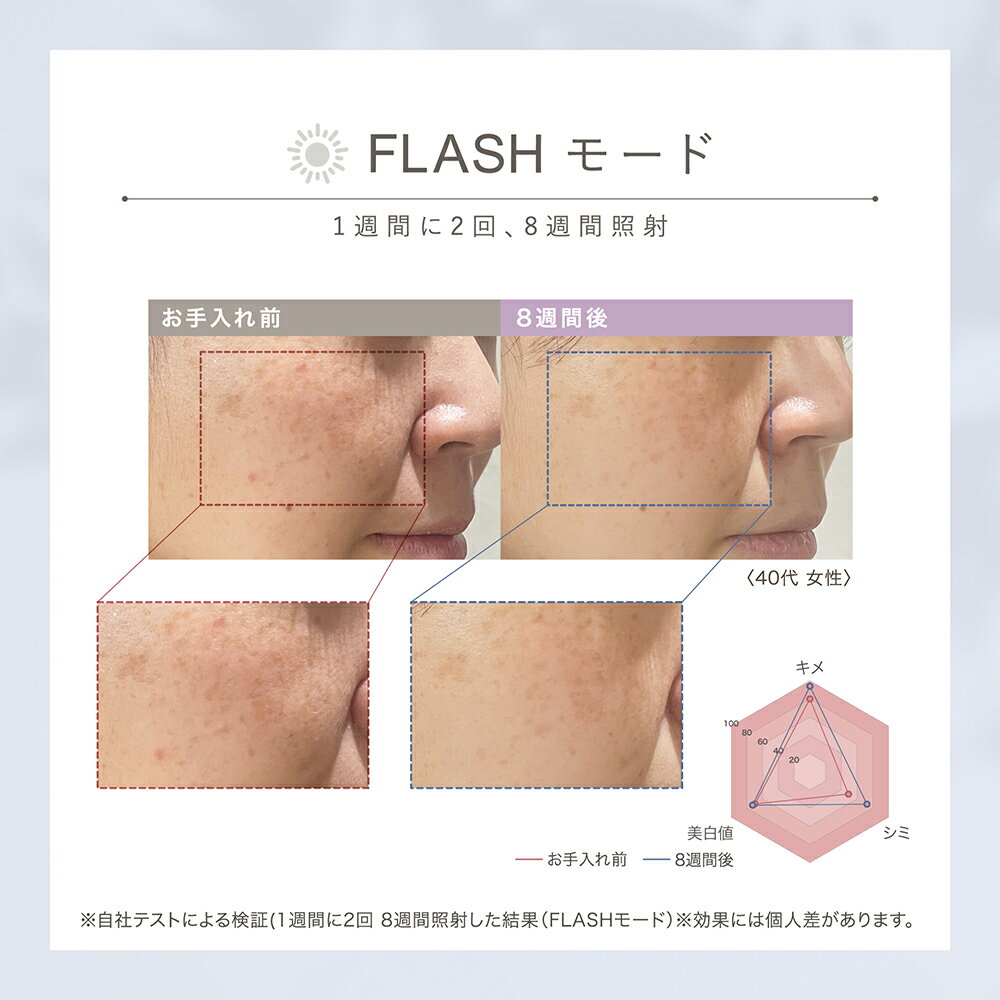 LINKA ��� ���Ρ� �ե�å��� DPL NIR �����ƴ� 1�ô֤�10��Ϣ³�ȼ� ���� �֥饤�ȥ��� �ϥ� ���� �ᤤ �ȡ��󥢥å� �ᥤ�������³ ��ȩ ����� �ե��ȥե�������� ���ե�������� ���ե� �ץ쥼��� ���� ����