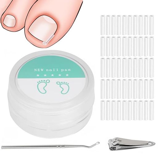 Rakuten - Chisafly 巻き爪クリップ 50個入り 巻き爪 足の巻き爪 ネイルケア器具1個 爪切り1個 陥入爪 特殊形状 はさむだけ 男女兼用