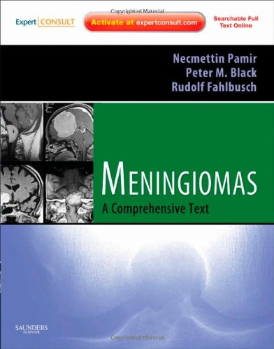 Meningiomas: Expert Consult - Online and Print, 1e (Expert Consult Title: Online + Print)