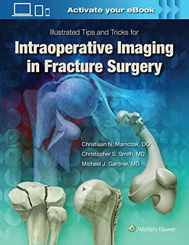 楽天AJIMURA-SHOP【中古】【未使用・未開封品】Illustrated Tips and Tricks for Intraoperative Imaging in Fracture Surgery