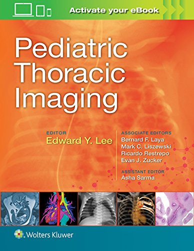 樂天商城 - 【中古】【未使用・未開封品】Pediatric Thoracic Imaging