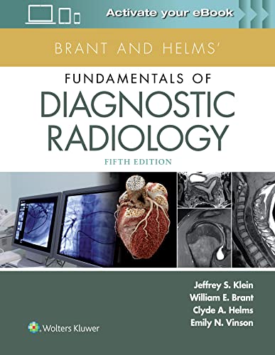 楽天AJIMURA-SHOP【中古】【未使用・未開封品】Brant and Helms' Fundamentals of Diagnostic Radiology