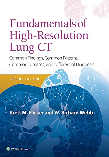 楽天AJIMURA-SHOP【中古】【未使用・未開封品】Fundamentals of High-Resolution Lung CT: Common Findings, Common Patterns, Common Diseases and Differential Diagnosis