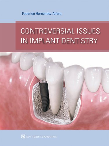 楽天AJIMURA-SHOP【中古】【未使用・未開封品】Controversial Issues in Implant Dentistry