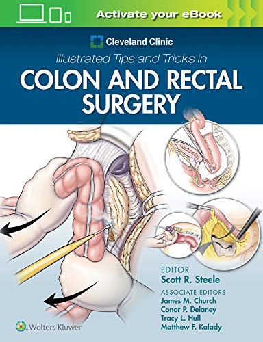 【中古】【未使用・未開封品】Cleveland Clinic Illustrated Tips and Tricks in Colon and Rectal Sur..