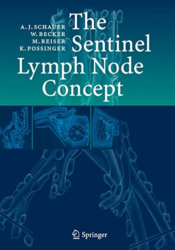 The Sentinel Lymph Node Concept
